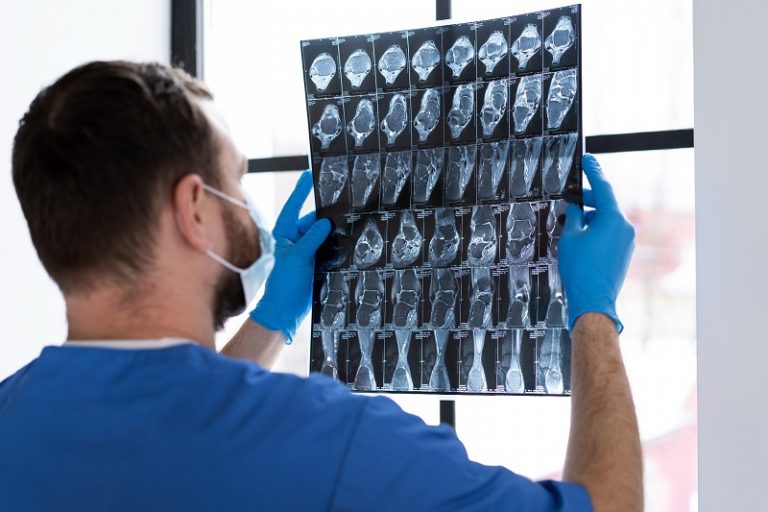 Município orienta para o descarte correto de radiografias e raios X